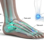 족부 전문의가 설명하는 발 아치와 전신 건강